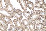 PIAS1 Antibody in Immunohistochemistry (Paraffin) (IHC (P))