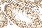 PIAS1 Antibody in Immunohistochemistry (Paraffin) (IHC (P))