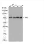 PIAS1 Antibody in Western Blot (WB)