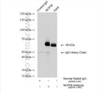 NOP58 Antibody in Immunoprecipitation (IP)