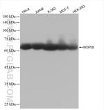 NOP58 Antibody in Western Blot (WB)