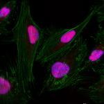 DEK Antibody in Immunocytochemistry (ICC/IF)