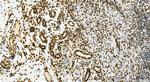 DEK Antibody in Immunohistochemistry (Paraffin) (IHC (P))