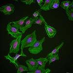MYCL1 Antibody in Immunocytochemistry (ICC/IF)