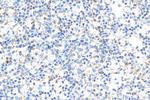 OAS1 Antibody in Immunohistochemistry (Paraffin) (IHC (P))