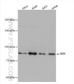 NBN/NBS1 Antibody in Western Blot (WB)