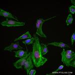 Emerin Antibody in Immunocytochemistry (ICC/IF)