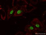 Emerin Antibody in Immunocytochemistry (ICC/IF)