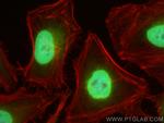 Emerin Antibody in Immunocytochemistry (ICC/IF)