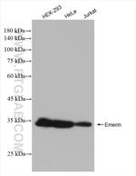 Emerin Antibody in Western Blot (WB)