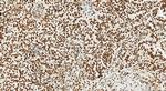 RBM17 Antibody in Immunohistochemistry (Paraffin) (IHC (P))