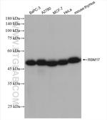 RBM17 Antibody in Western Blot (WB)