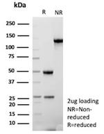 ARID1A/SMARCF1 Antibody in SDS-PAGE (SDS-PAGE)