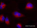 RRBP1 Antibody in Immunocytochemistry (ICC/IF)