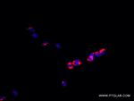 RRBP1 Antibody in Immunocytochemistry (ICC/IF)
