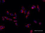 RRBP1 Antibody in Immunocytochemistry (ICC/IF)