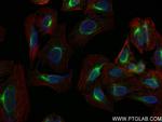 TRIM62 Antibody in Immunocytochemistry (ICC/IF)
