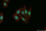 NSUN2 Antibody in Immunocytochemistry (ICC/IF)