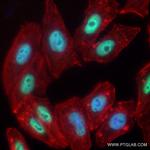 NSUN2 Antibody in Immunocytochemistry (ICC/IF)