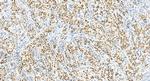 NSUN2 Antibody in Immunohistochemistry (Paraffin) (IHC (P))