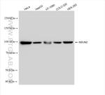 NSUN2 Antibody in Western Blot (WB)