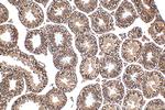FANCM Antibody in Immunohistochemistry (Paraffin) (IHC (P))