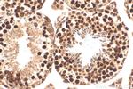 FANCM Antibody in Immunohistochemistry (Paraffin) (IHC (P))