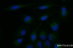 Synaptophysin Antibody in Immunocytochemistry (ICC/IF)