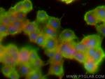 Synaptophysin Antibody in Immunocytochemistry (ICC/IF)