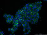 LAT Antibody in Immunocytochemistry (ICC/IF)