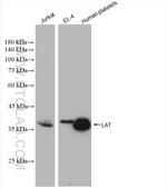 LAT Antibody in Western Blot (WB)