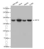 KIF15 Antibody in Western Blot (WB)