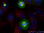 AURKA Antibody in Immunocytochemistry (ICC/IF)
