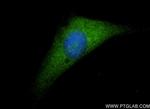 IL-18 Antibody in Immunocytochemistry (ICC/IF)