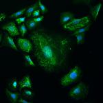 BAZ2A Antibody in Immunocytochemistry (ICC/IF)