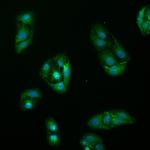 BAZ2A Antibody in Immunocytochemistry (ICC/IF)