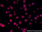 TBCD Antibody in Immunocytochemistry (ICC/IF)