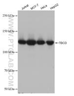 TBCD Antibody in Western Blot (WB)