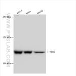 TBCD Antibody in Western Blot (WB)