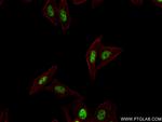 ZC3H11A Antibody in Immunocytochemistry (ICC/IF)