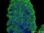 PARK7/DJ-1 Antibody in Immunocytochemistry (ICC/IF)