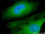 MYOF Antibody in Immunocytochemistry (ICC/IF)