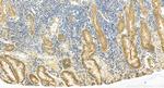 PICK1 Antibody in Immunohistochemistry (Paraffin) (IHC (P))
