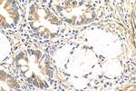 PICK1 Antibody in Immunohistochemistry (Paraffin) (IHC (P))