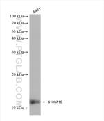 S100A16 Antibody in Western Blot (WB)
