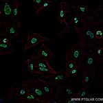 NFX1 Antibody in Immunocytochemistry (ICC/IF)