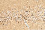 STMN2 Antibody in Immunohistochemistry (Paraffin) (IHC (P))