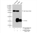 STMN2 Antibody in Immunoprecipitation (IP)