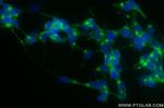 STMN2 Antibody in Immunocytochemistry (ICC/IF)