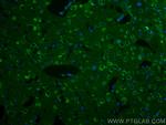 STMN2 Antibody in Immunohistochemistry (PFA fixed) (IHC (PFA))
